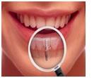 Implants Dentist - Cosmetic Dentist - Bayside, NY 11361 - (347)467-1588 | ShowMeLocal.com