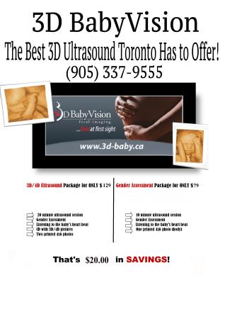3d babyvision 3d ultrasound toronto special deals-$79! 3D Babyvision-3D Ultrasound Toronto Toronto (905)337-9555