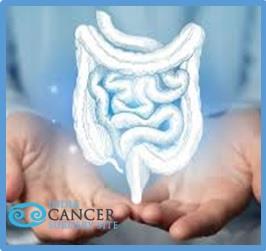 Low Cost Of Colon Cancer Treatment - London, London WC2H 9HD - 09371 770341 | ShowMeLocal.com