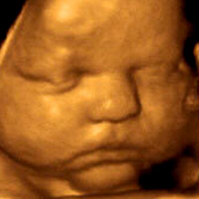 3D Ultrasound Center Of Orlando By Prenatal Impressions - Orlando, FL 32835 - (407)521-8390 | ShowMeLocal.com