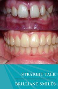 Dr Straight Teeth - Toowoomba, QLD 4350 - (07) 4638 0710 | ShowMeLocal.com