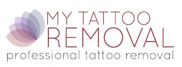 My Tattoo Removal - Holland Park, QLD 4121 - (07) 3397 5153 | ShowMeLocal.com