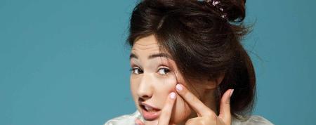 Tips To Follow To Avoid And Prevent Pimples - Pomona, CA 91766 - (323)537-6877 | ShowMeLocal.com